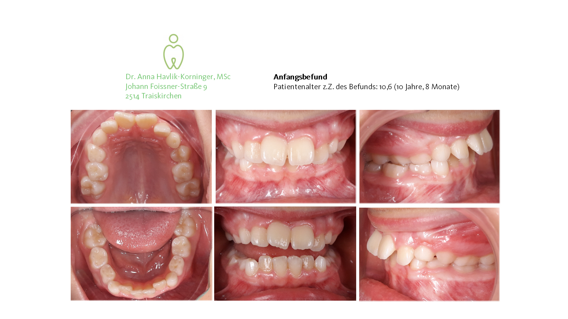 Walt Mikela - Homepage Anfang